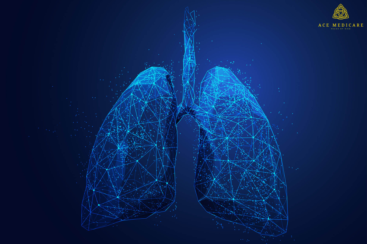 The Power of a Lung Transplant: A Comprehensive Guide
